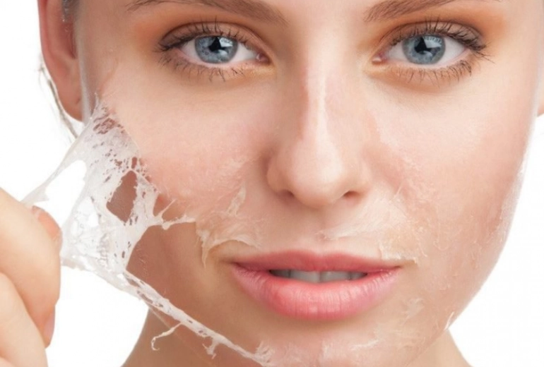 Peel Da Hóa Học Tại MEDIKA WELLNESS & SPA – Chăm Sóc Da Chuyên Sâu