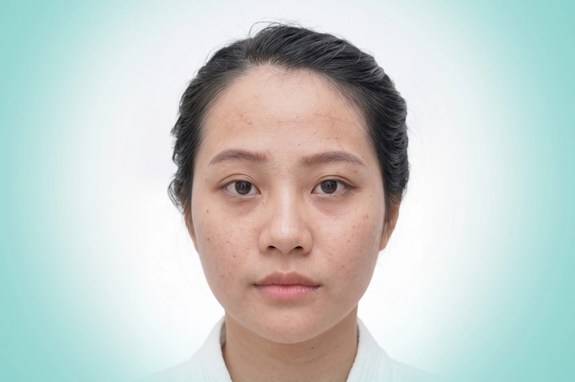 DA LIỄU & TRẺ HÓA